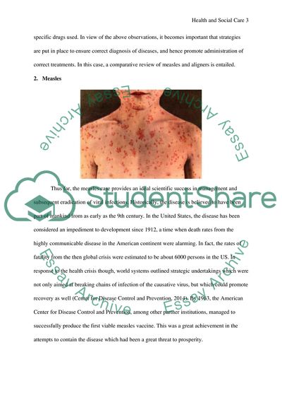 Health And Social Care: Investigating Disease Coursework