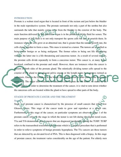 Treatment of Prostate Cancer
