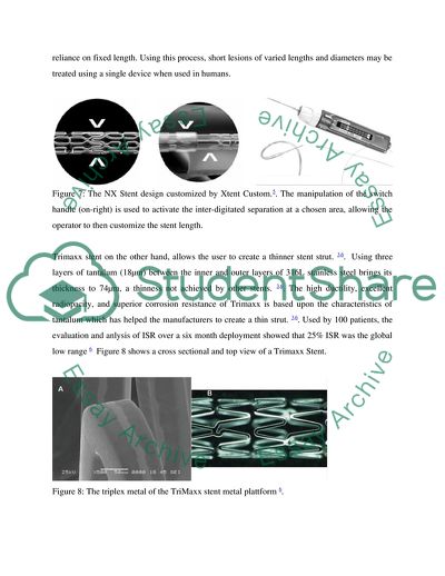 Rephrasing Stent Fracture