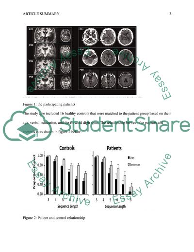 Memory Integration in Amnesia: Prior Knowledge Supports Verbal Short-Term Memory